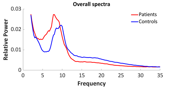 Figura 2. Espectros de frecuencias para el grupo DCL frente al grupo control